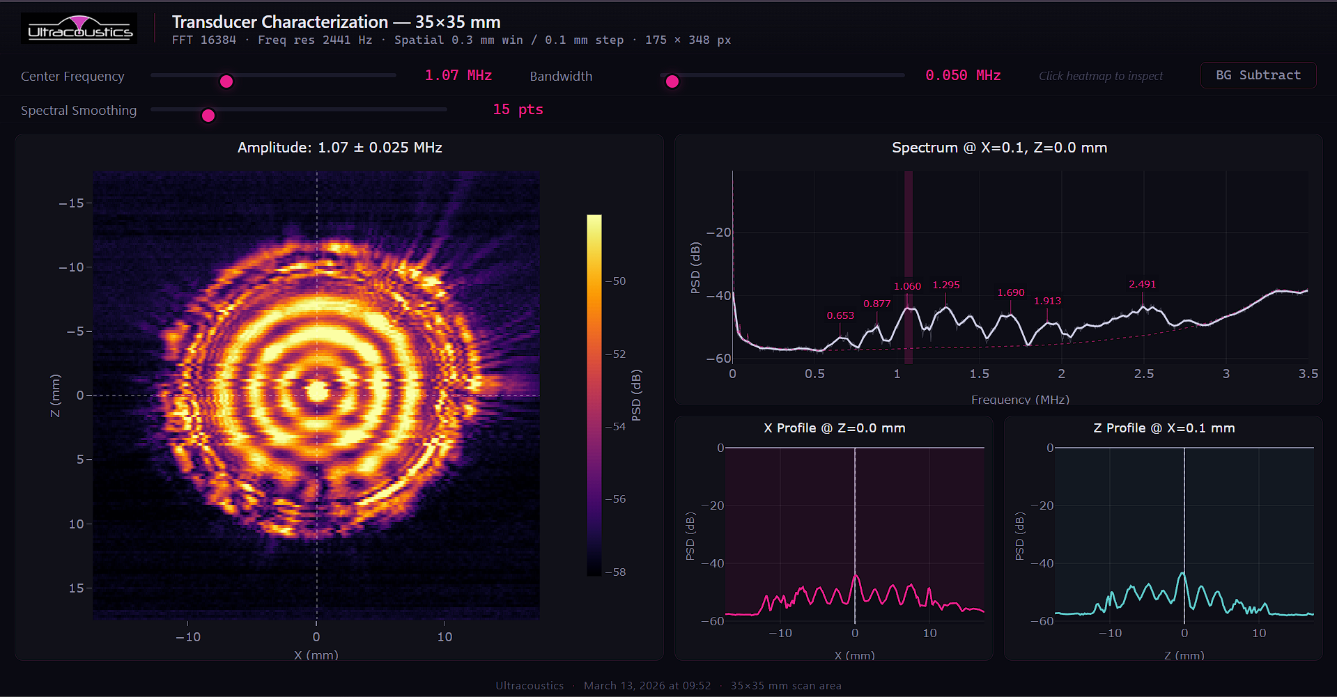 Interactive transducer scan report — 1.5 MHz transducer